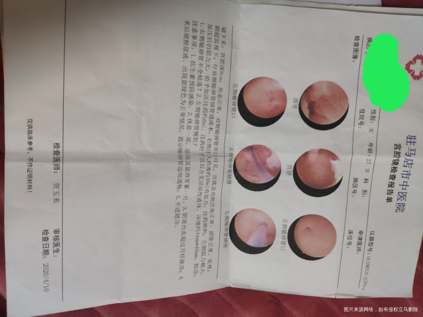 有多囊现在在吃二甲双胍片还有暖宫孕子胶囊此外