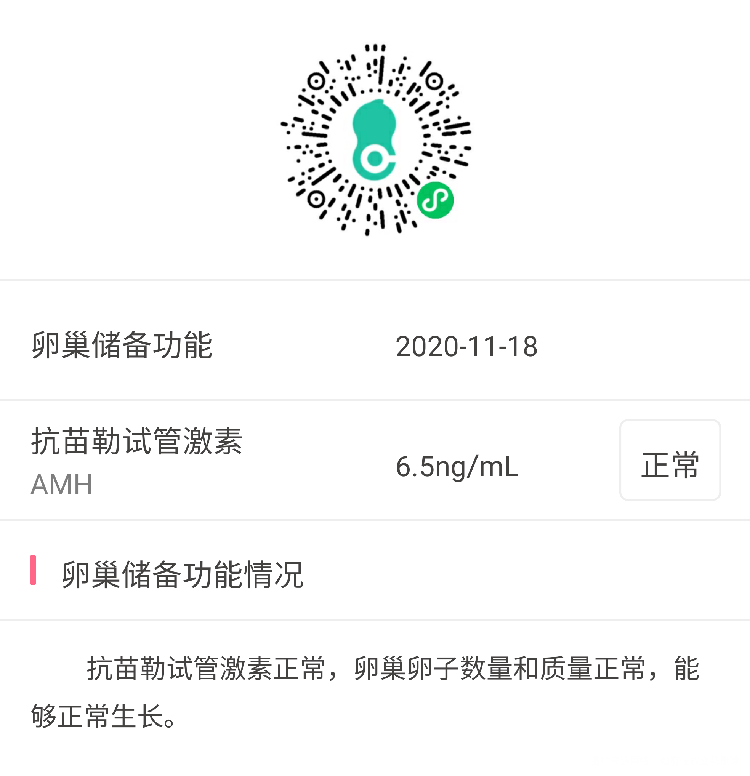 不确定是否排卵是否症状为多囊月经时而提前是否