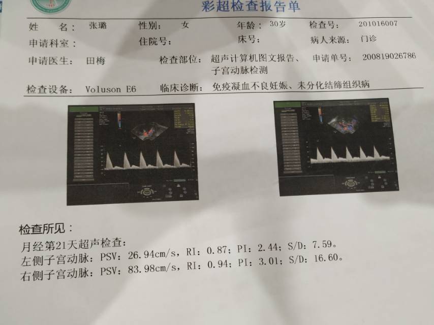 两次孕八周发现胎停第二次检测流产物22号染色