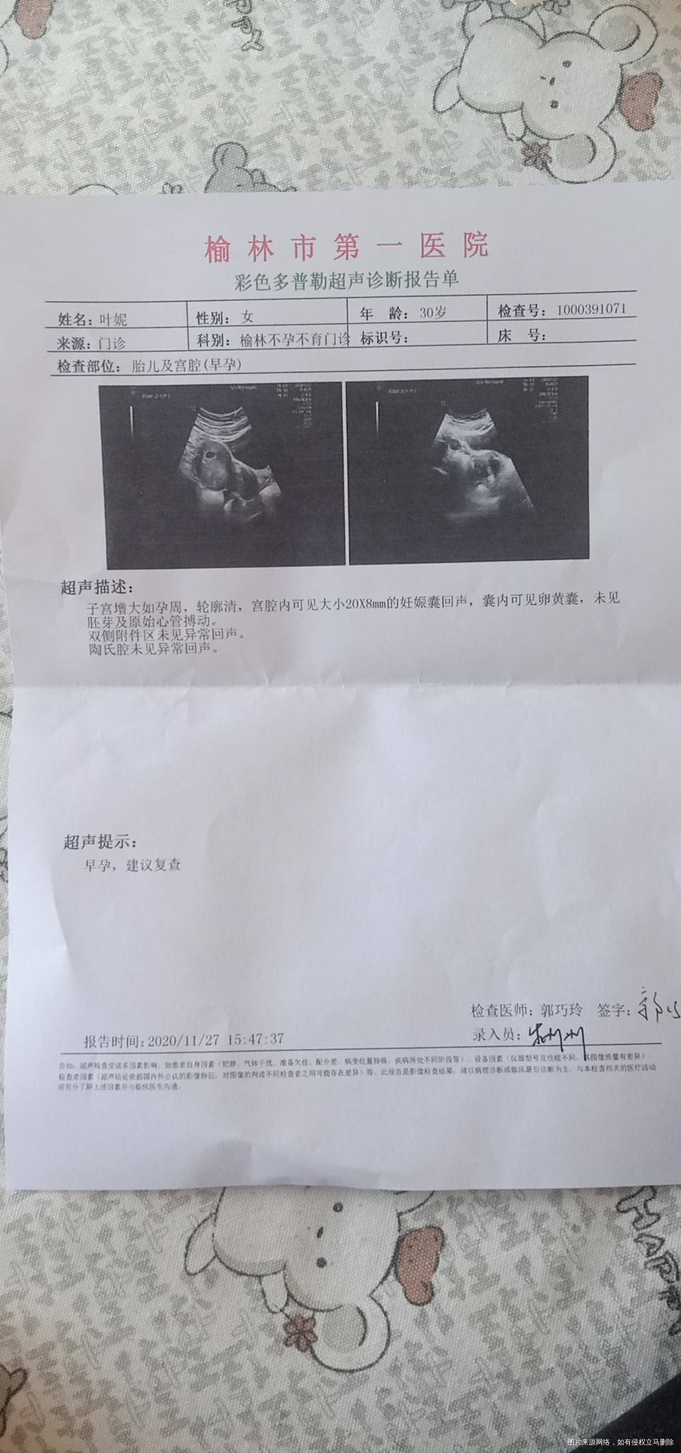 11月2号移植…孕43天B超妊娠囊208有卵