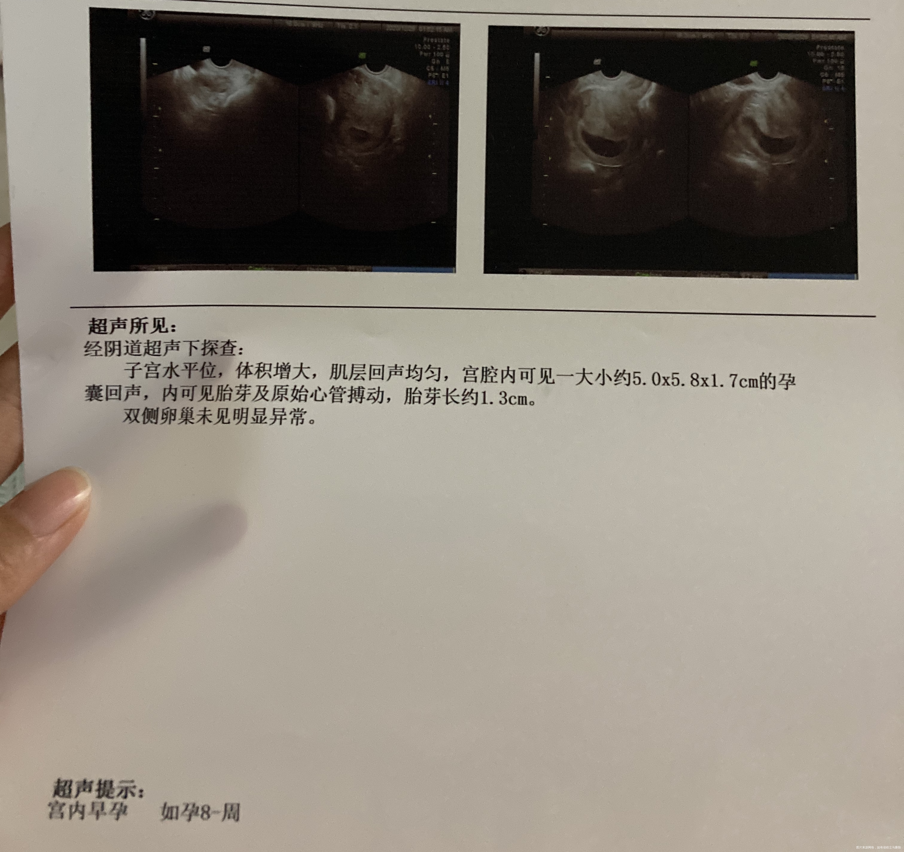 分别是怀孕7周6天和6周4天报告9天胎芽才涨