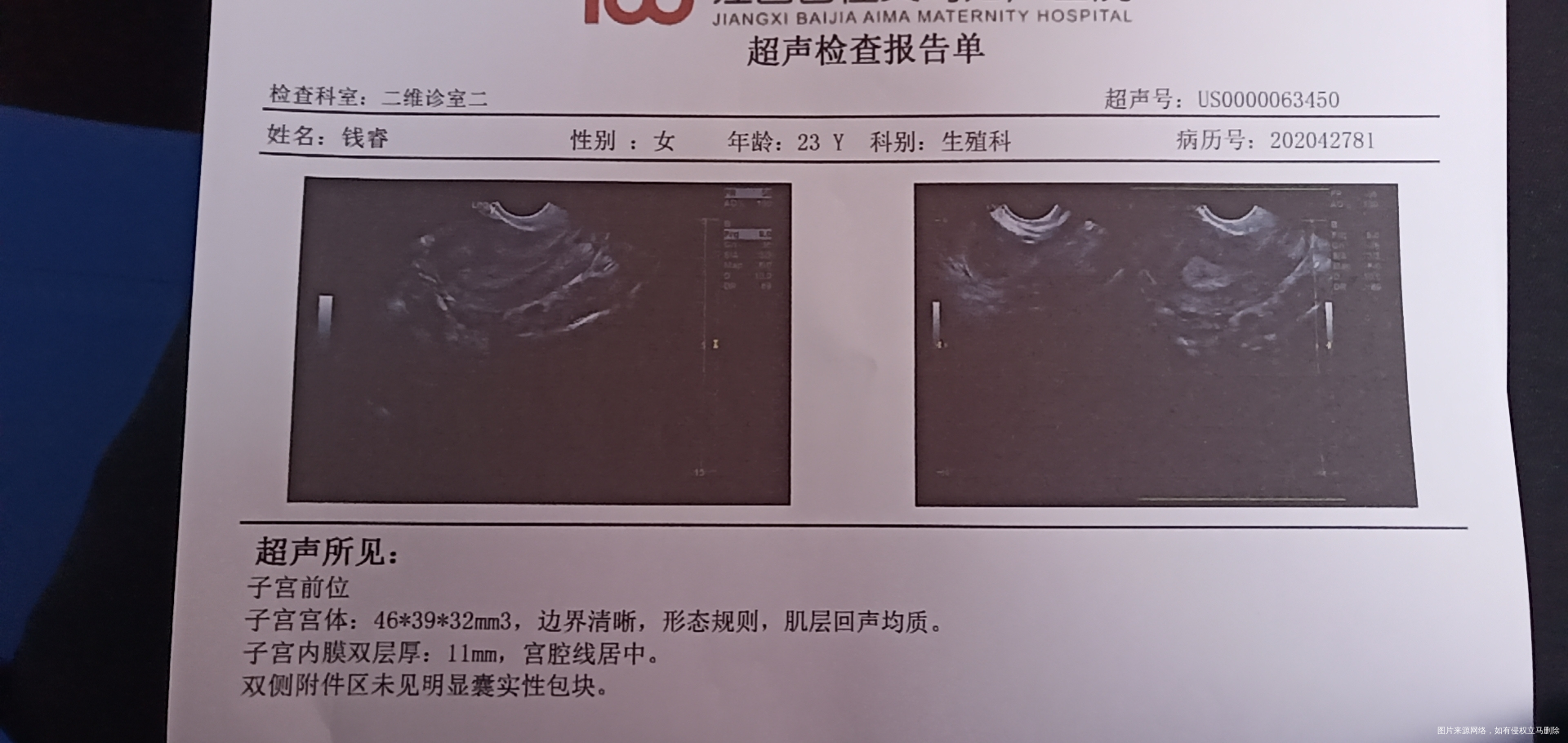 做了白带检测尿检和抽血B超显示有霉菌阴道炎吧