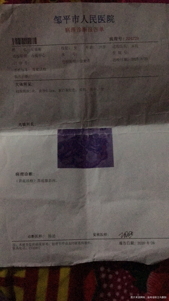 肚脐周围每天都疼痛不知道什么原因引起的但是做