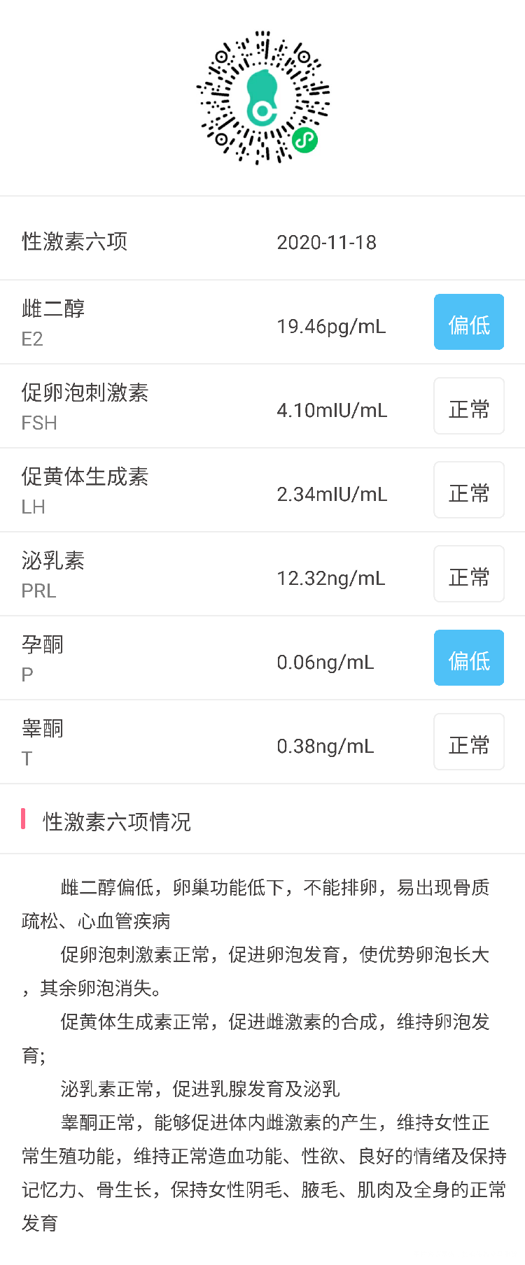 不确定是否排卵是否症状为多囊月经时而提前是否