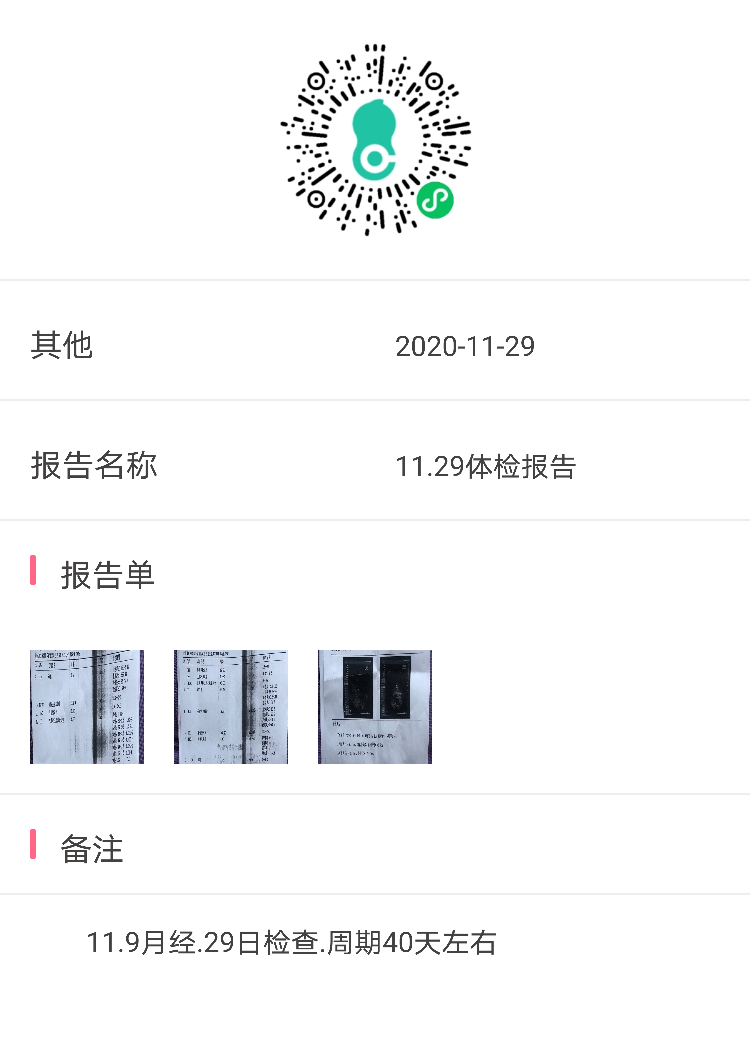 月经40天左右来一次量不多3~4天结束无流产