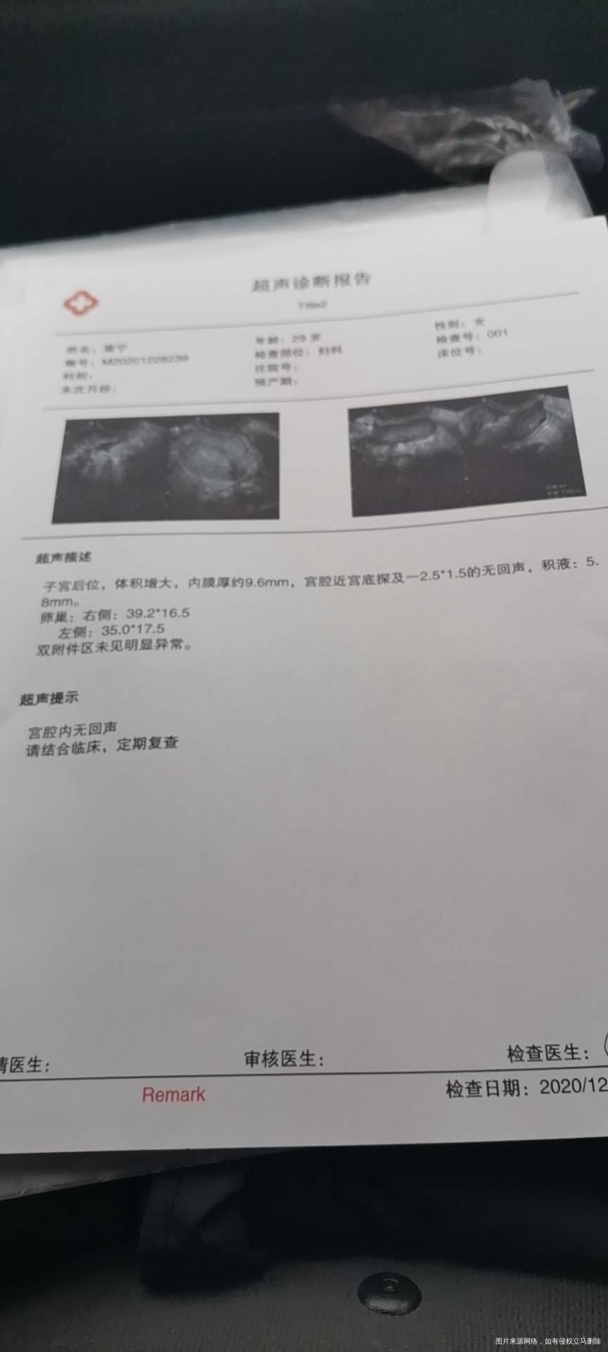 16号开奖血值19422号血值2803今天血