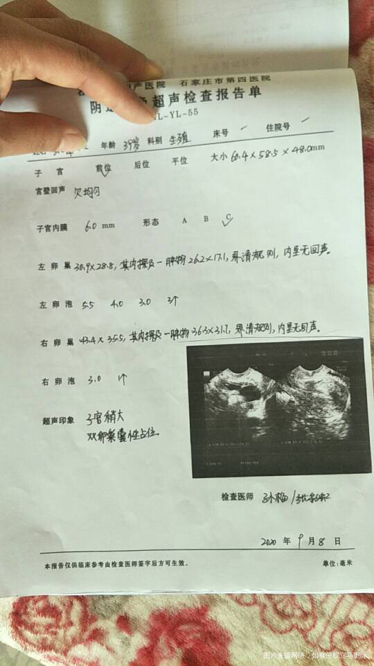 本人卵巢功能不好每月都有囊肿阻碍卵泡太小而且