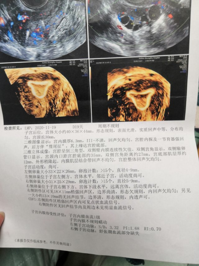 医生可以帮我看下这个单子有什么问题吗我是宫腔