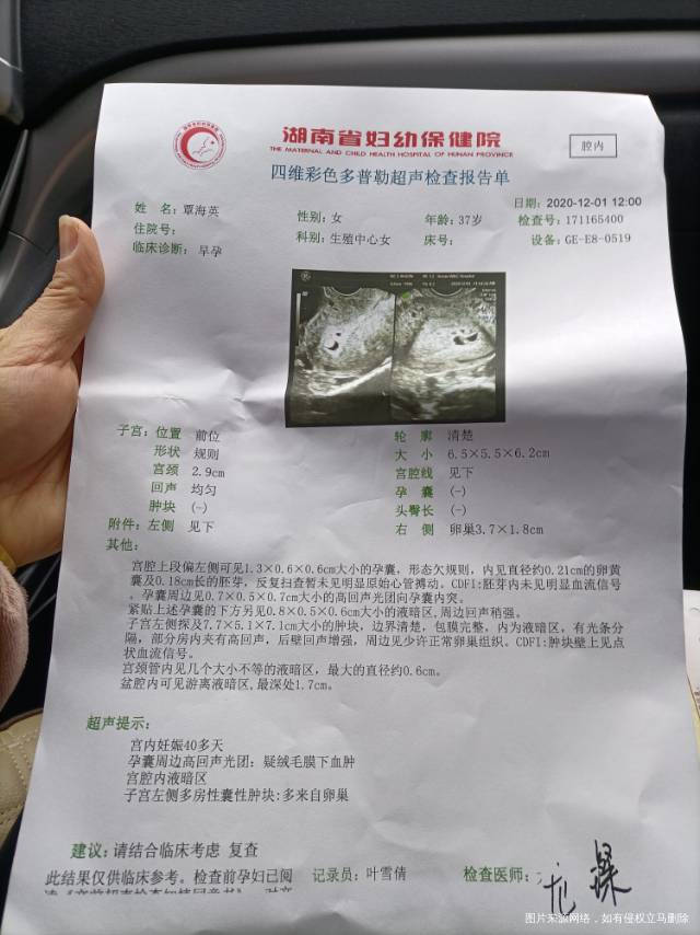 医生您好我促排怀孕53天今天做了B超请问医生