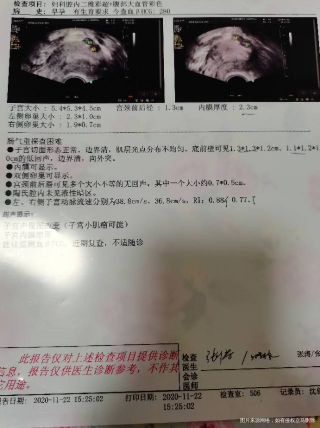 我11月10号移植两个囊胚11月20号hcg