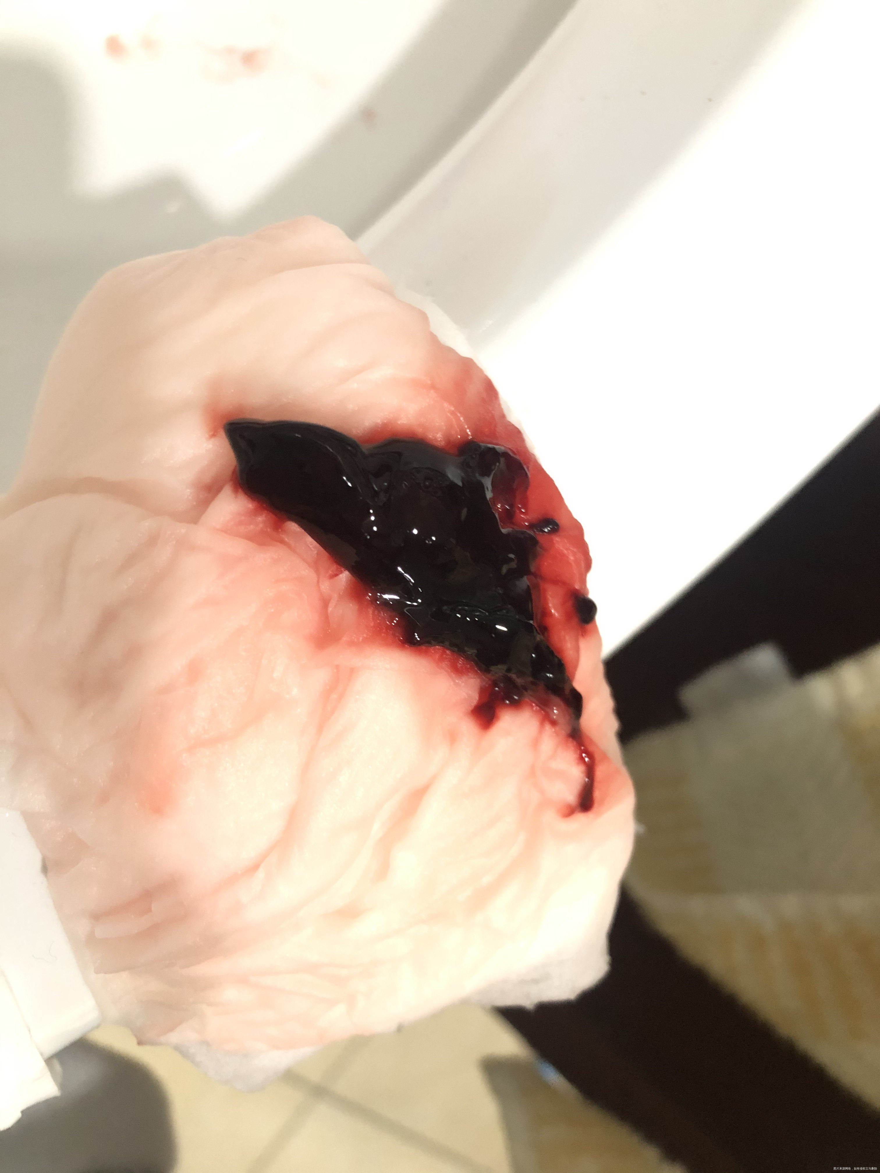 11月25日孕6周超声检查胎心胎芽都正常但是