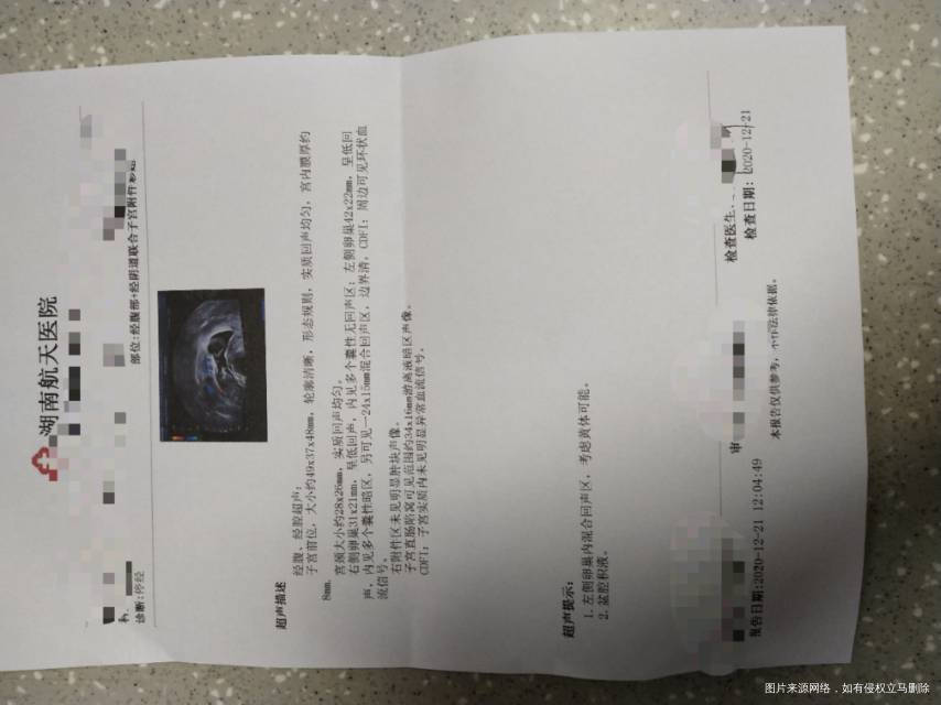 服用地屈孕酮片14天停药15天还没来月经前天