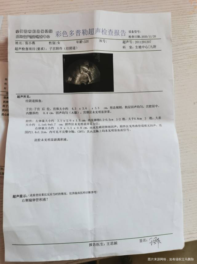 我第一次去检查有积水我吃中药调理了后面一边没