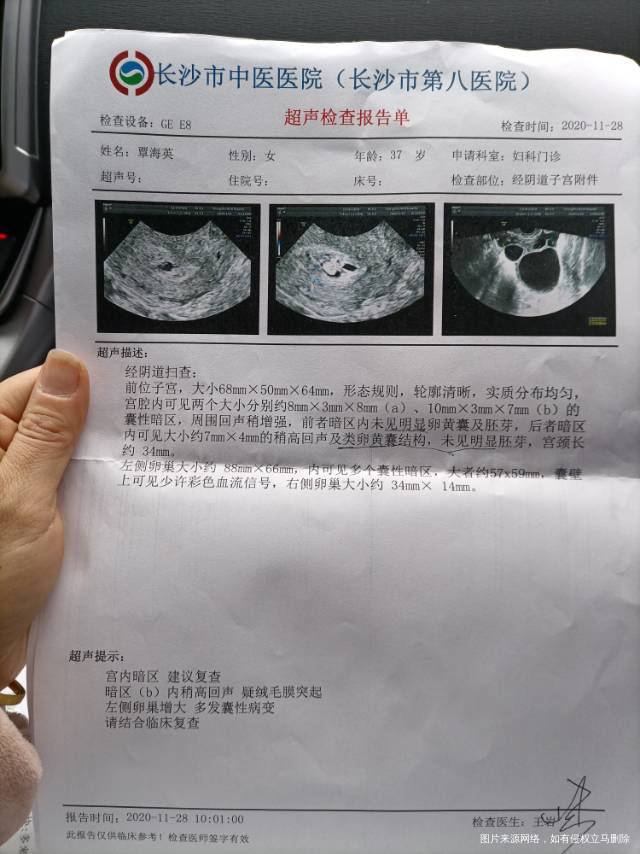 医生您好这是促排怀孕53天我也不知道有没有希