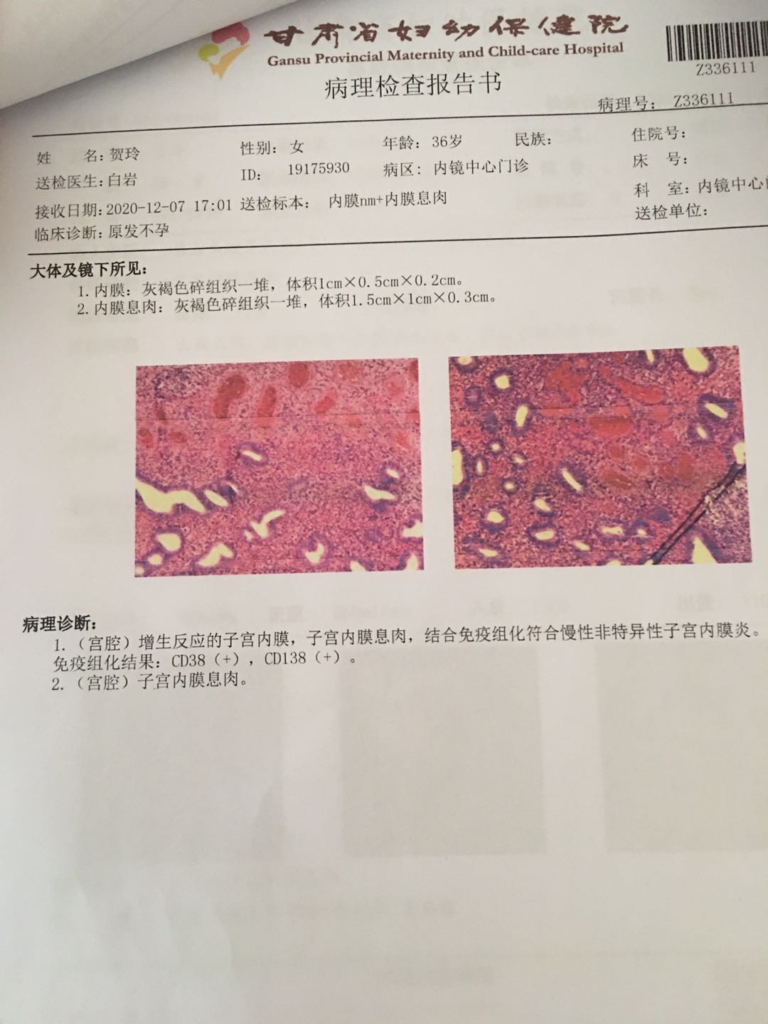 我12月7日做了宫腔镜检查有内膜息肉结合免疫