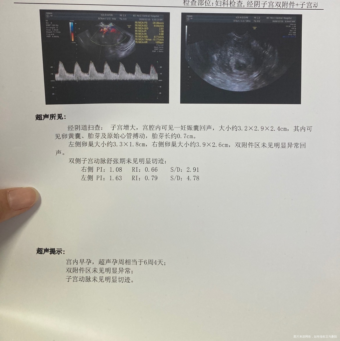 分别是怀孕7周6天和6周4天报告9天胎芽才涨