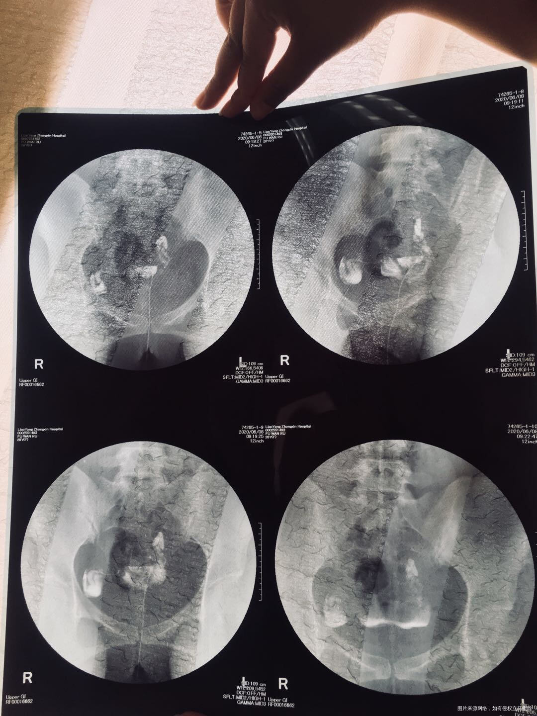 两年未怀孕没做过手术也没怀过孕2020年6月