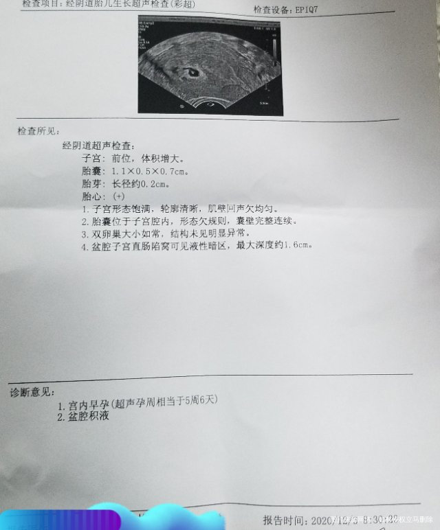 由于男方染色体异常试管三代11月9日移植第5