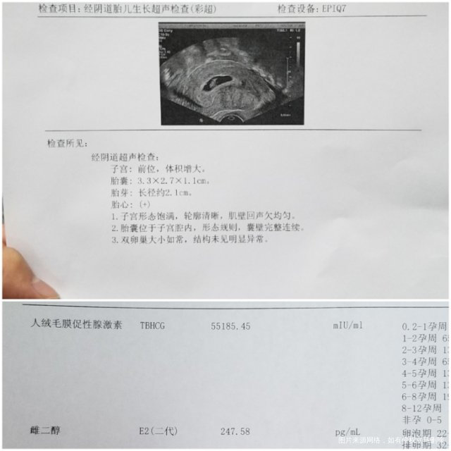试管移植日期算是孕9+1周今天抽血做彩超彩超