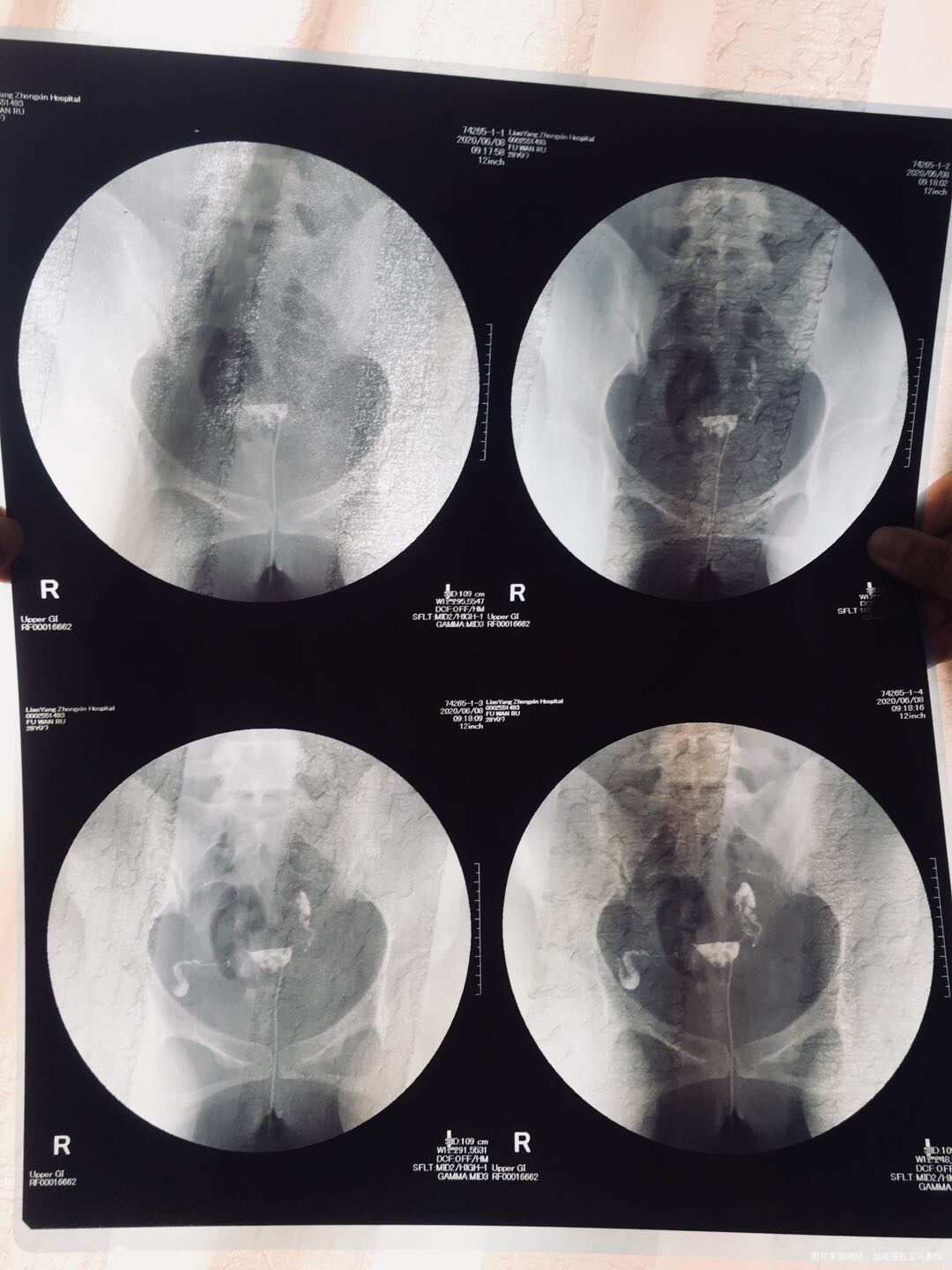 两年未怀孕没做过手术也没怀过孕2020年6月