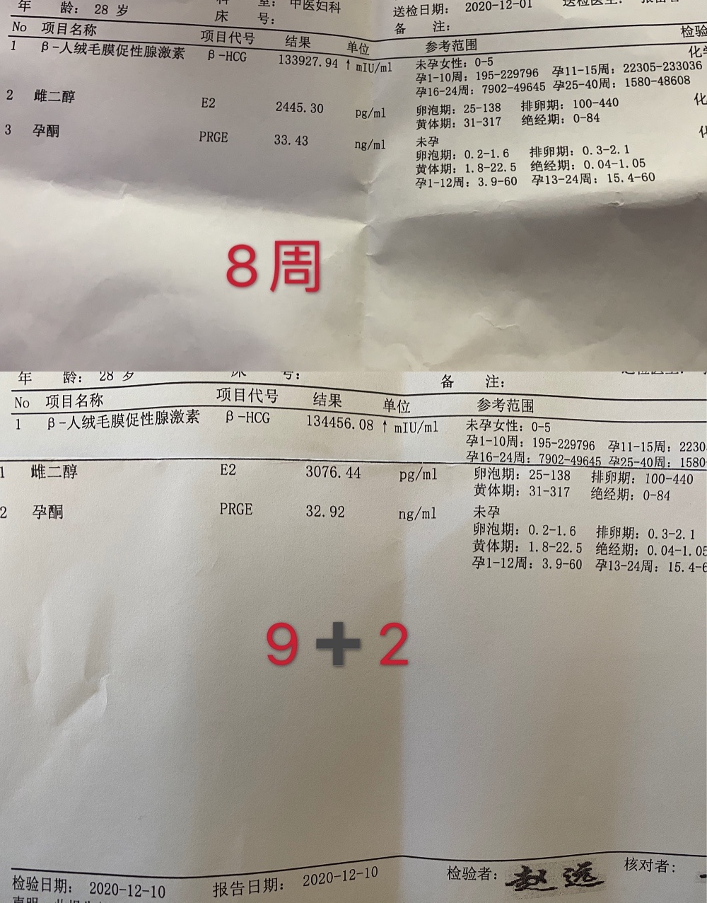 末次月经10月7日上周二8周化验hcg133