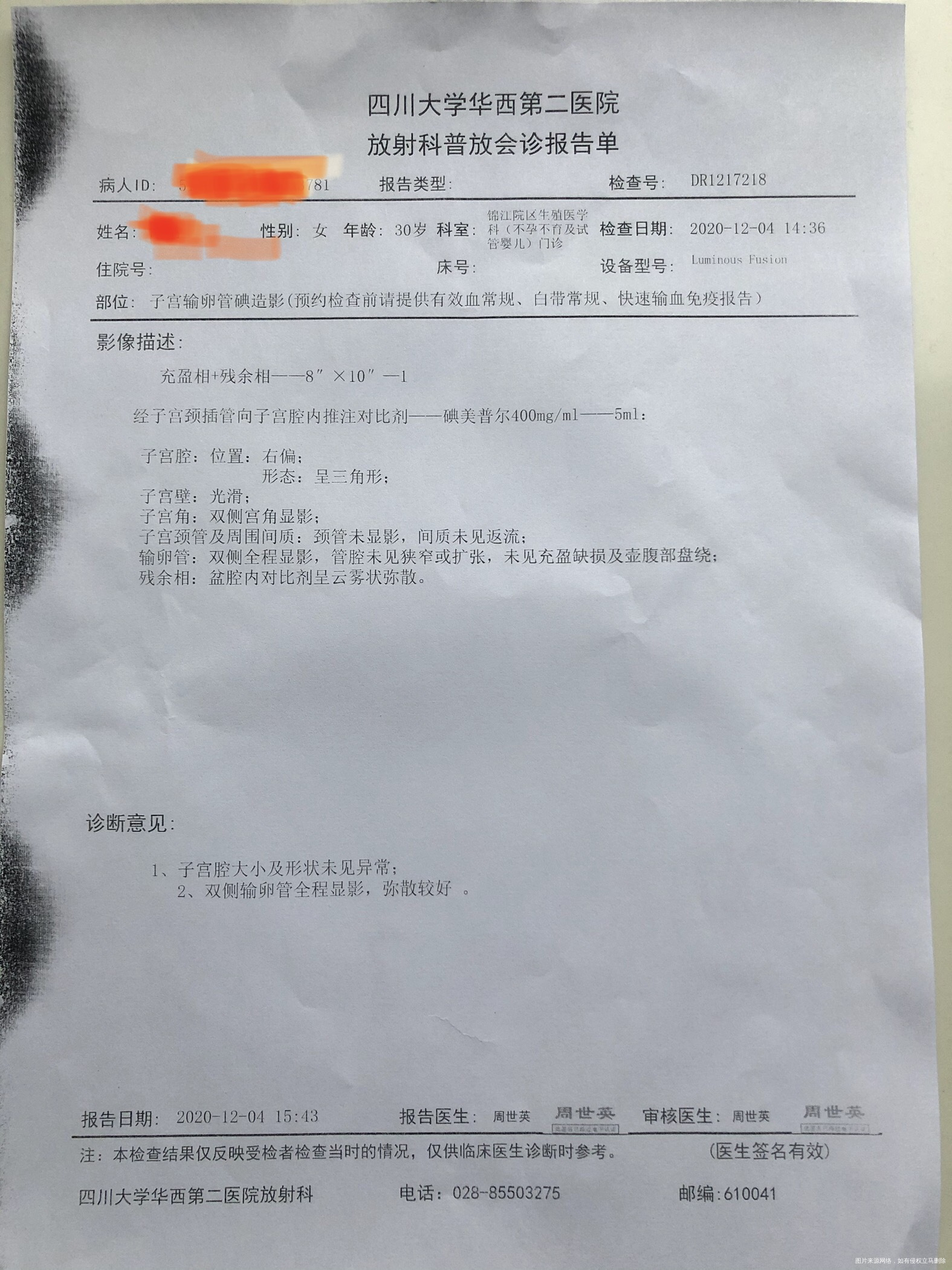 一年多都没怀起前两天做了造影做完拿报告第二天