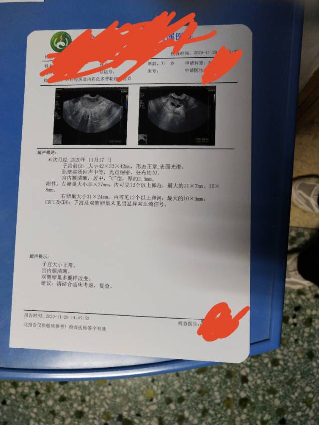内膜薄有泡泡多囊卵巢吃中药调理了四个月能同房