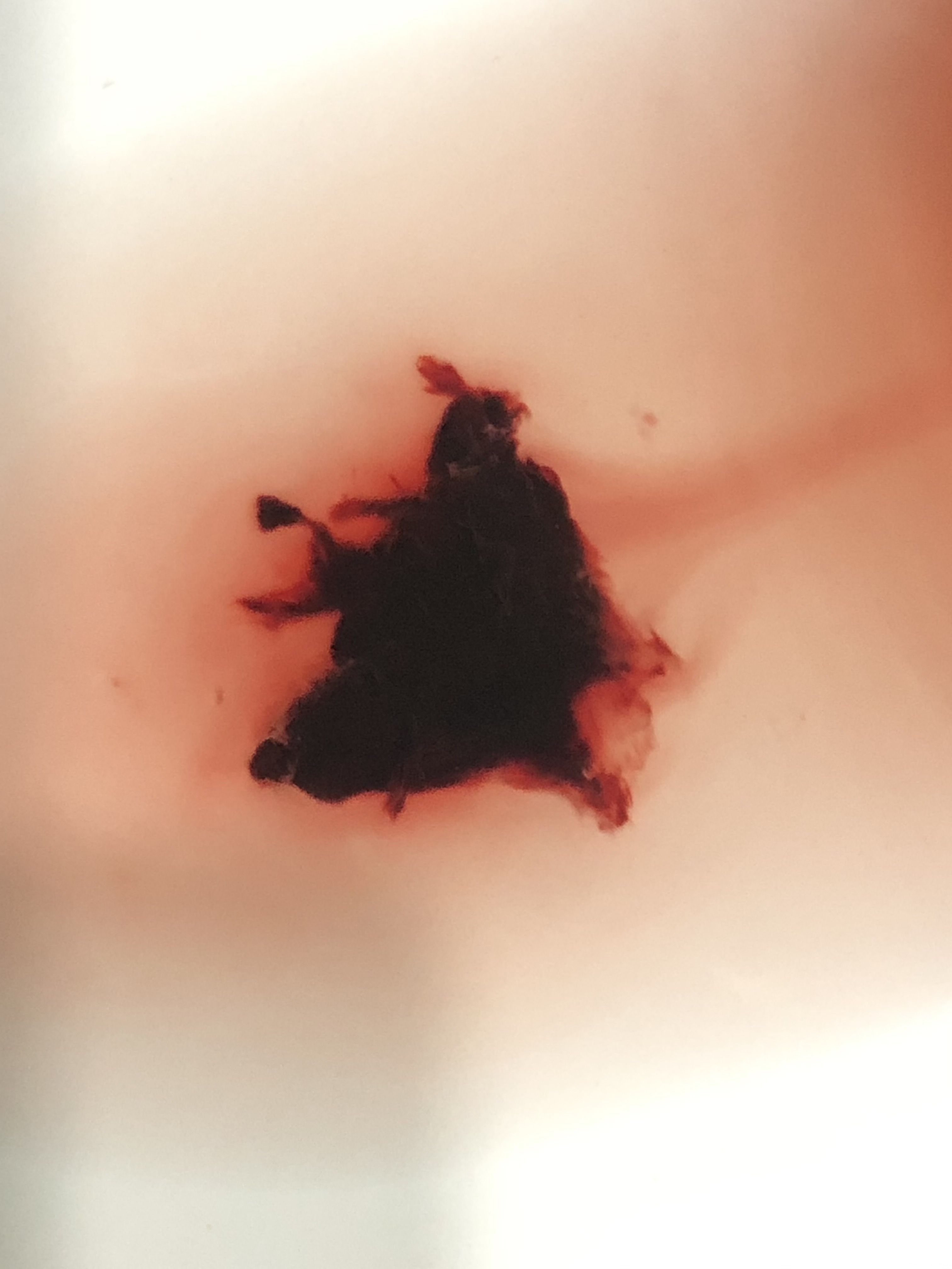 11月25日孕6周超声检查胎心胎芽都正常但是