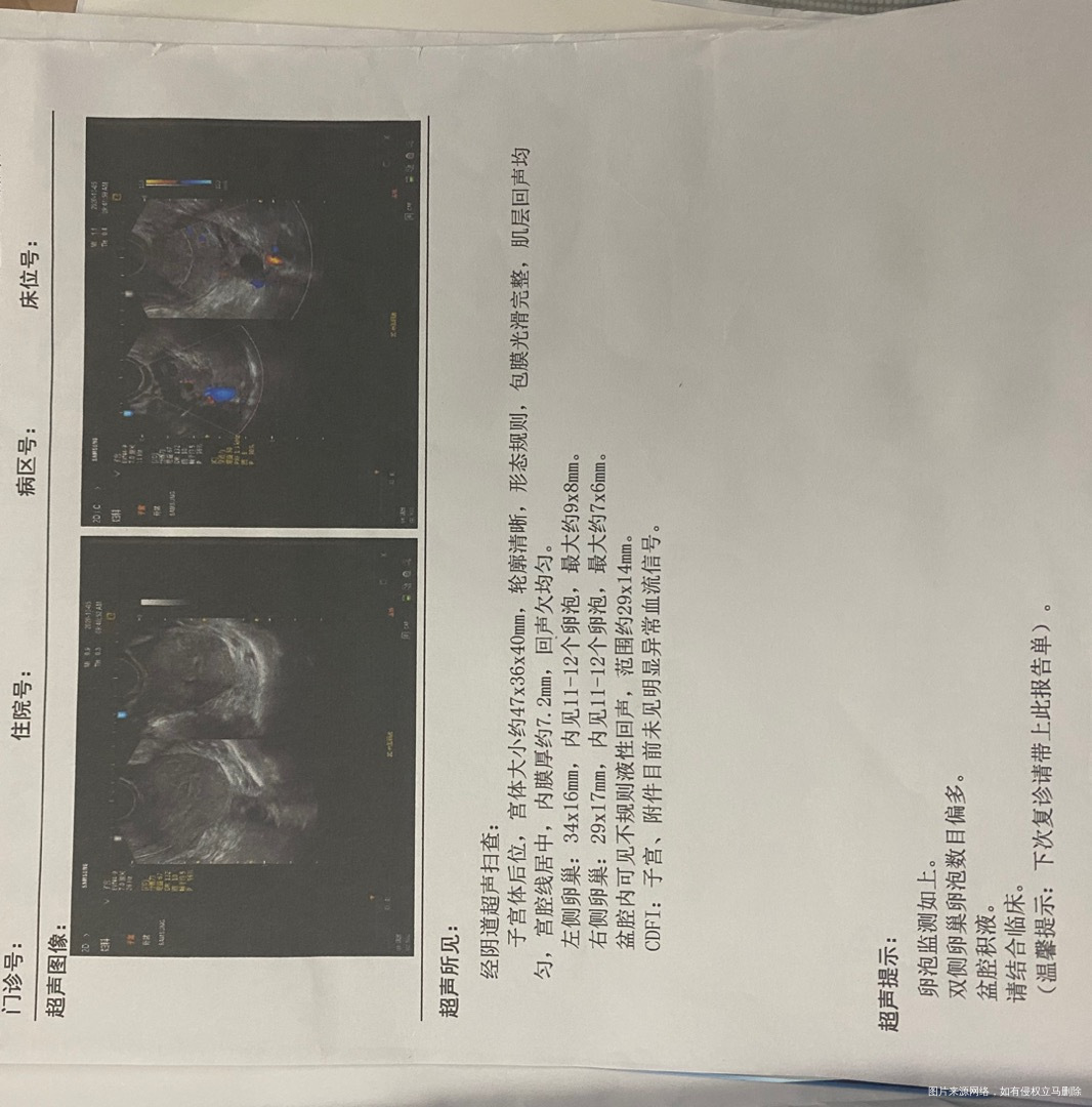 你好医生输卵管伞端上举黏连积水一定要手术吗不