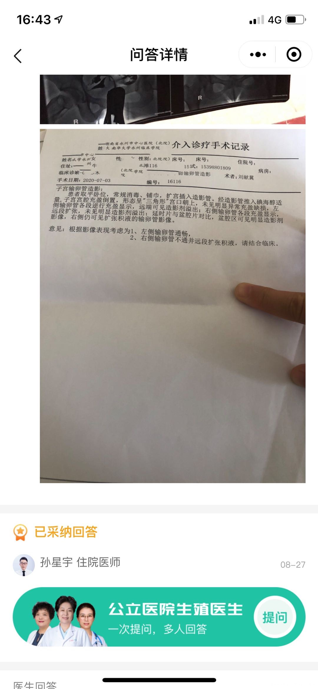请问这种情况有什么方法能尽快怀孕做人工受孕成