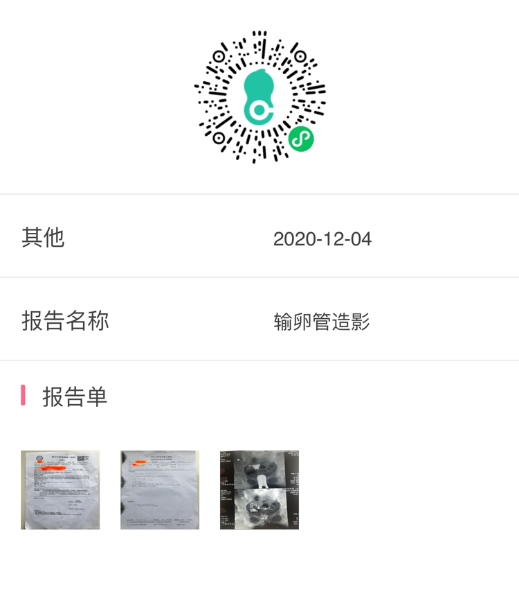 一年多都没怀起前两天做了造影做完拿报告第二天