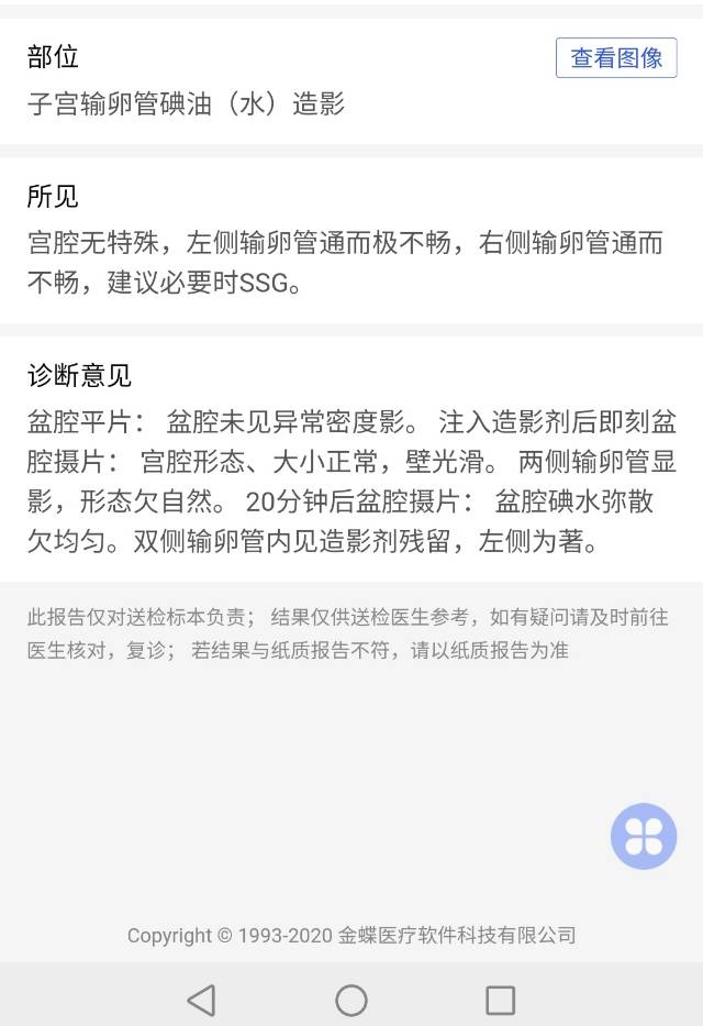 1214做的造影如图片不知道这输卵管到底咋样