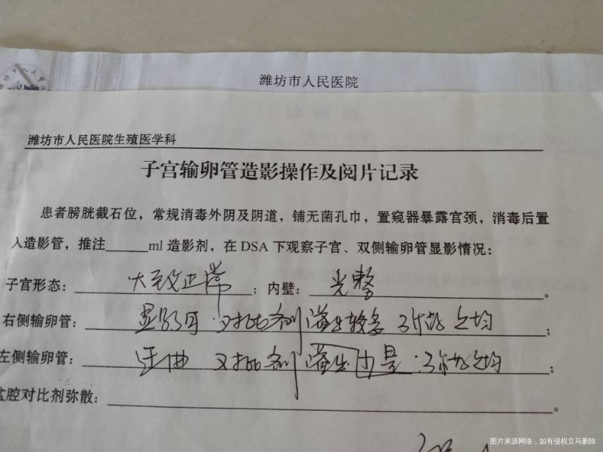 专家好我已备孕一年多了每个月来月经都是26到