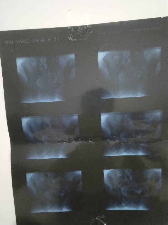 专家好我备孕一年多了月经基本都是2630天来