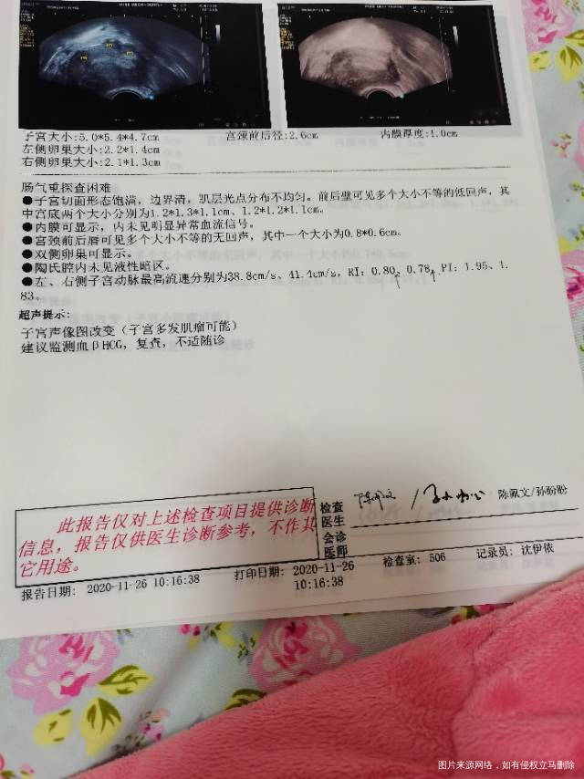 我11月10号移植两个囊胚11月20号hcg