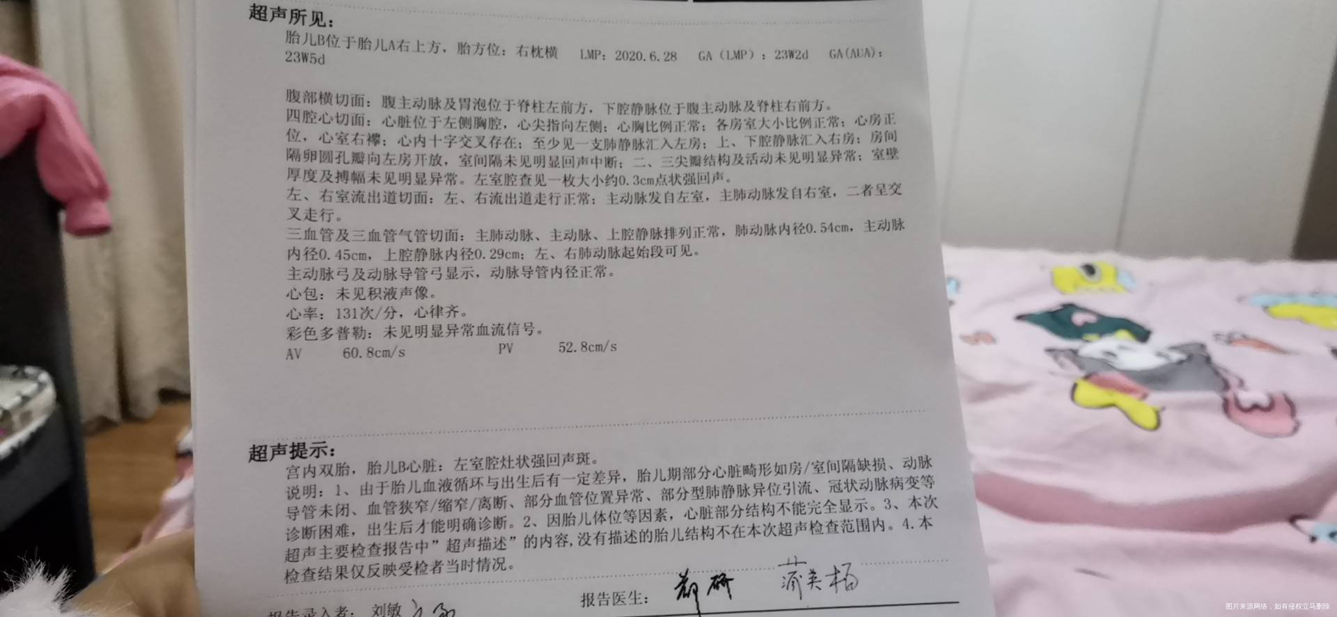 四维彩超显示双胞胎胎儿A肠管回声稍增强肺动脉