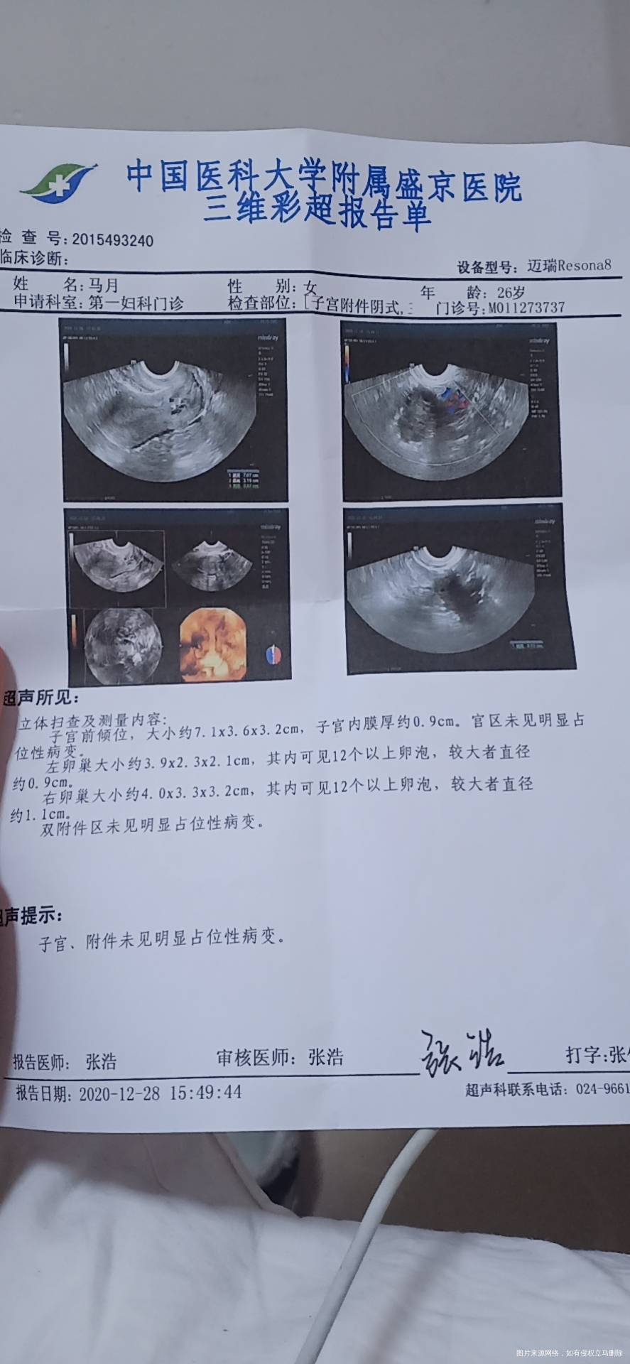今天检查的12个卵泡以上正常吗