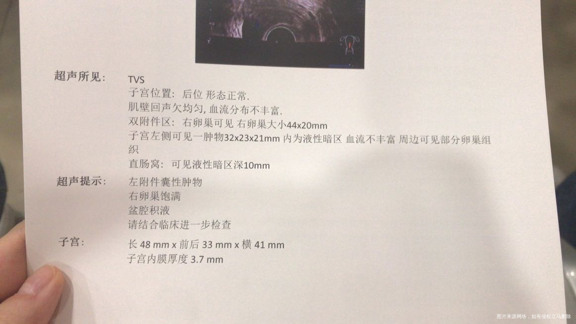 这个囊肿和多囊卵巢有联系吗