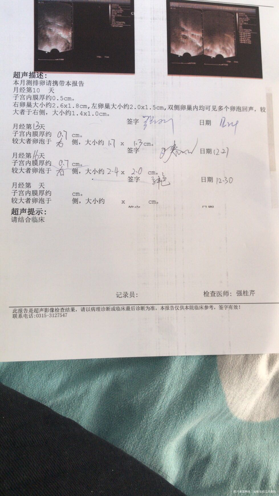 你好这是检测的卵泡目前没有排出怎么办