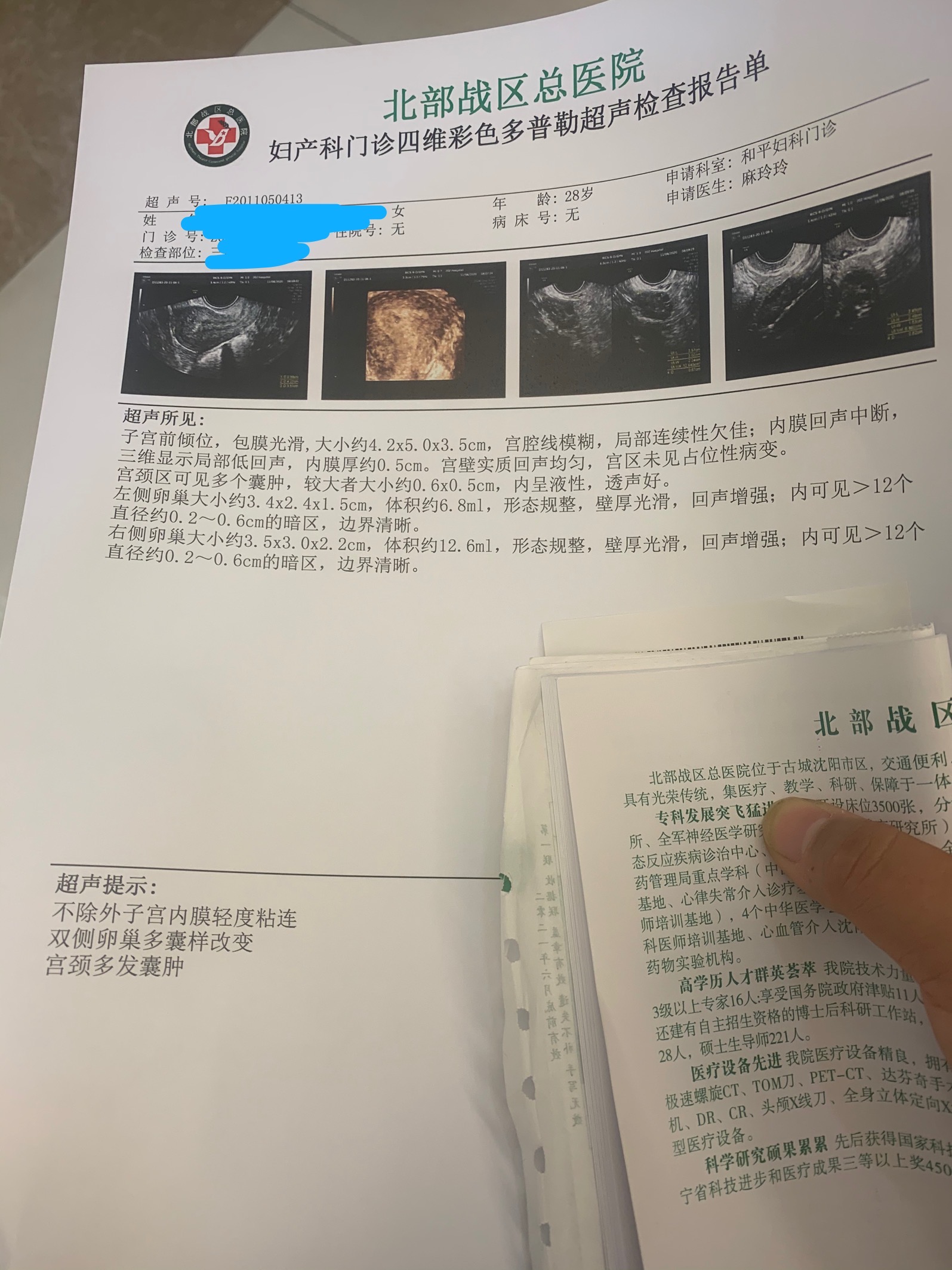 11月10号做的手术11月23号来的月经12