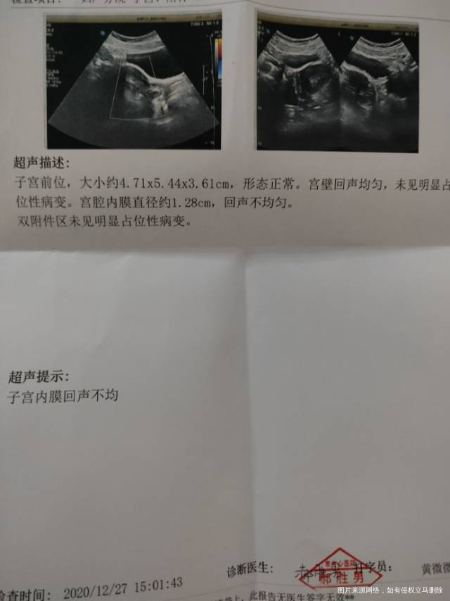 请医生帮我看看我这个有没有卵泡
