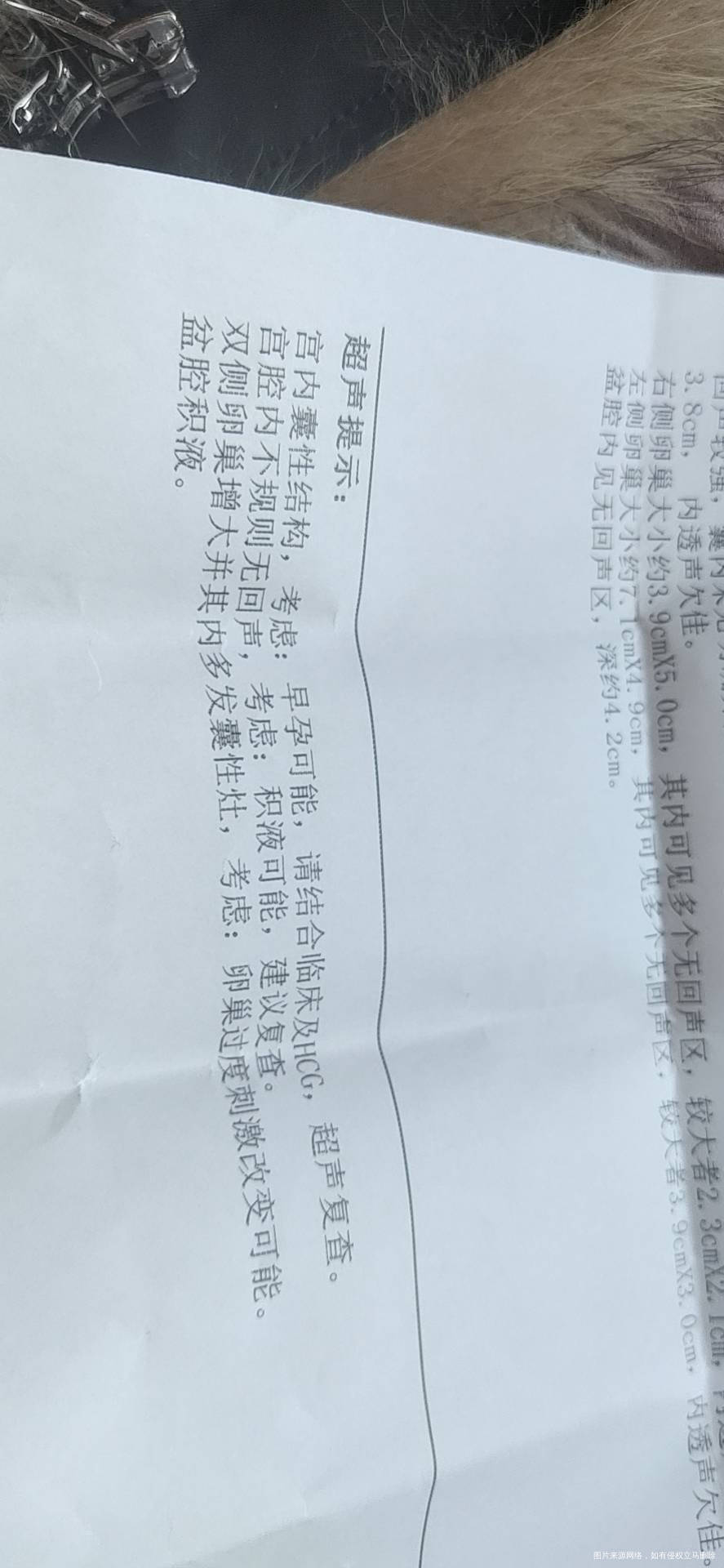 我移植鲜胚第二十七天做b超没有发现卵黄囊也没