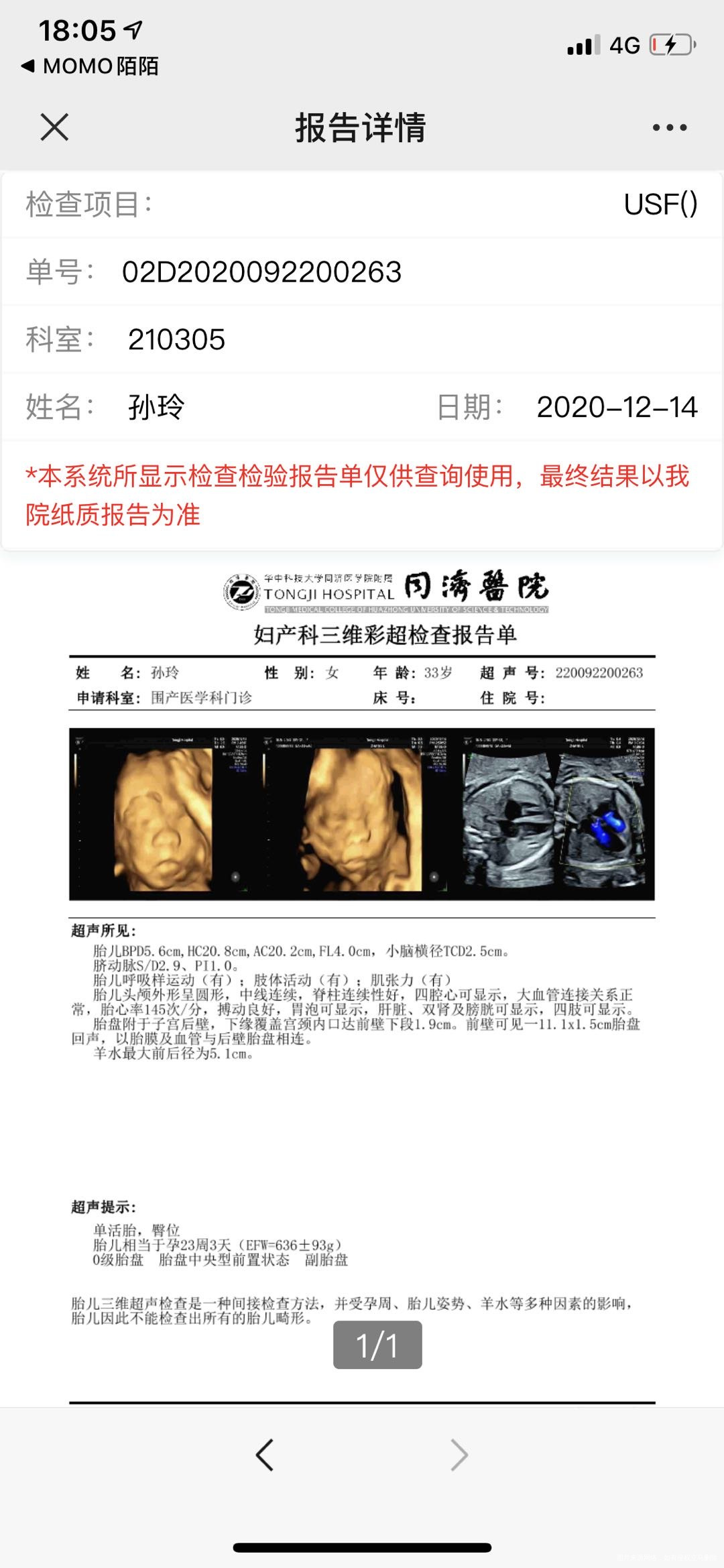 麻烦帮我看看报告单谢谢🙏