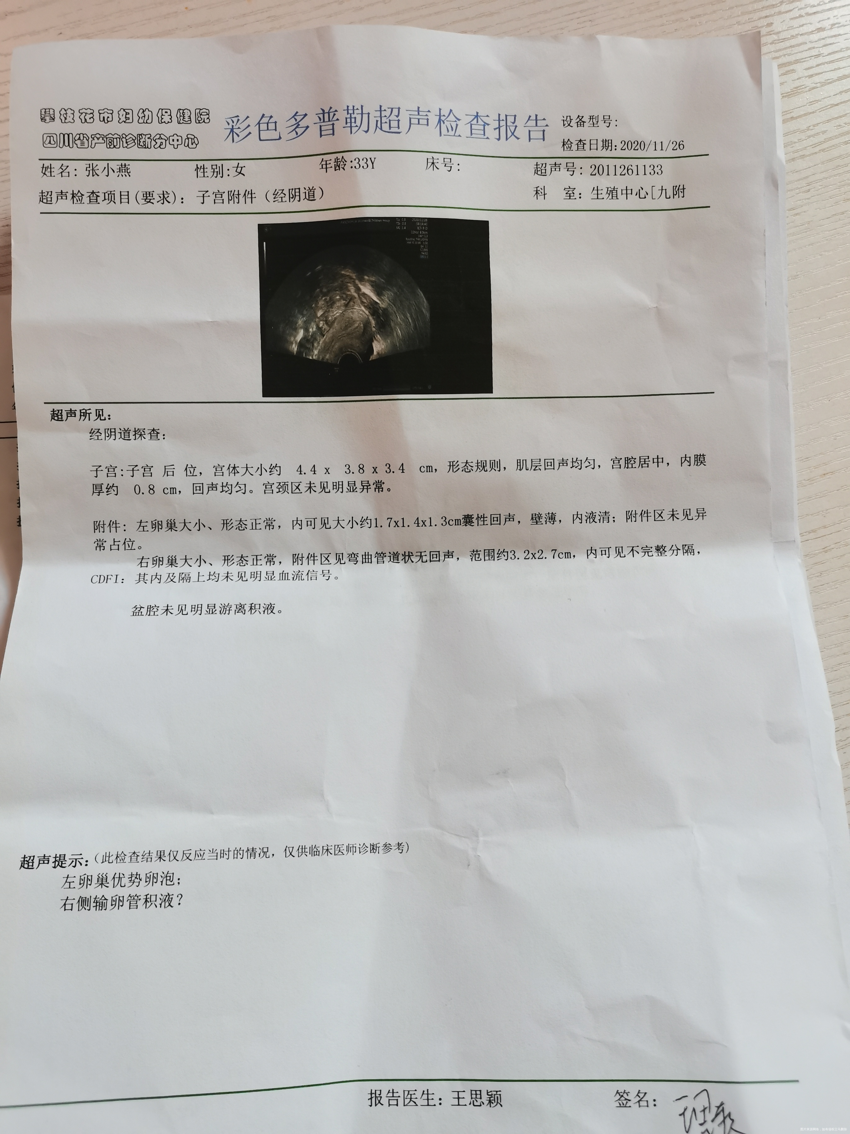 我第一次去检查有积水我吃中药调理了后面一边没