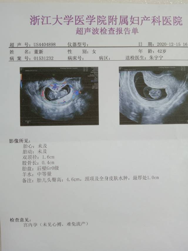 医生您好我今年42岁自然怀孕是第一次怀孕末次