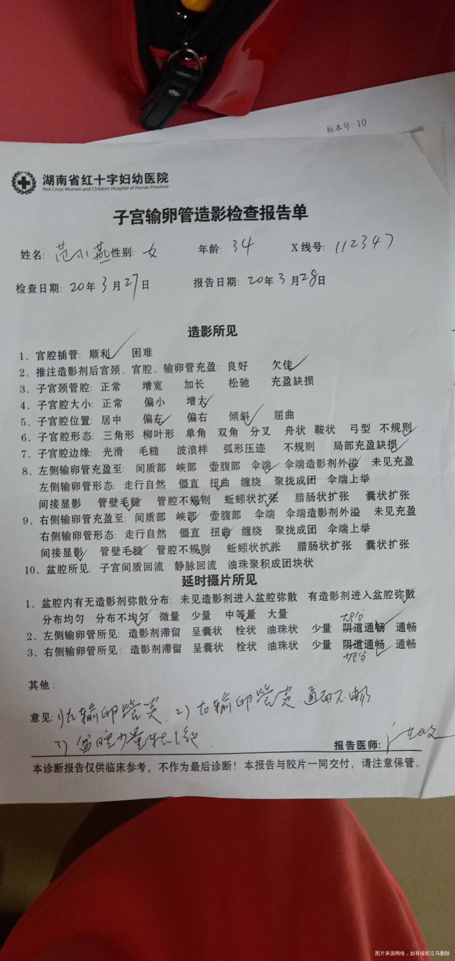 您好医生我今年35岁我在今年3月份做了输卵管