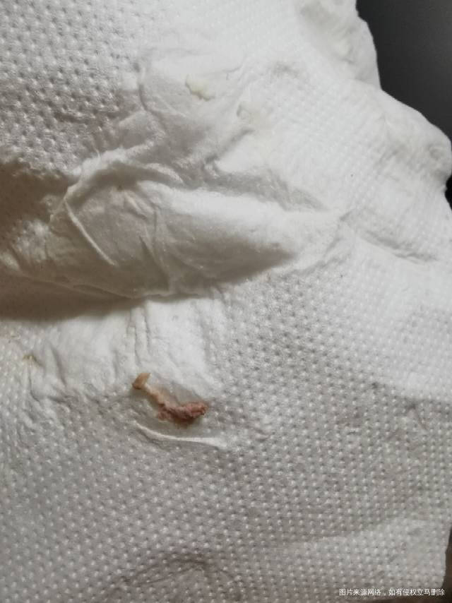 移植第十七天已成功之前都是打黄体酮开奖后换了