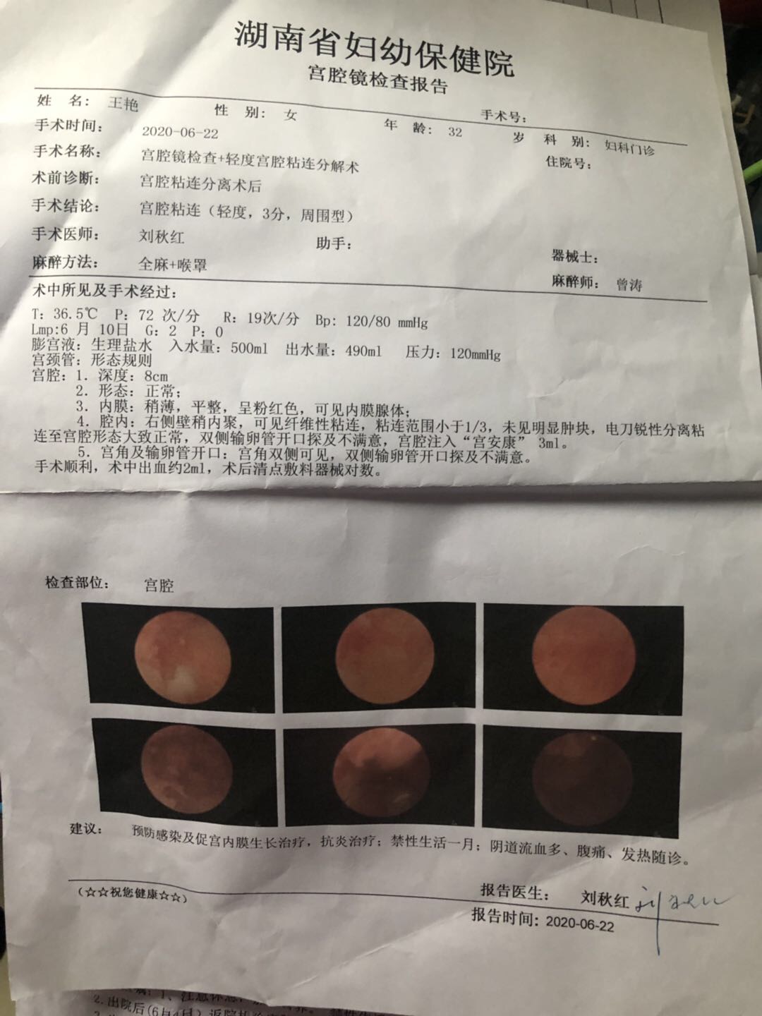 由于流产造成宫腔粘连中度8分2020528进