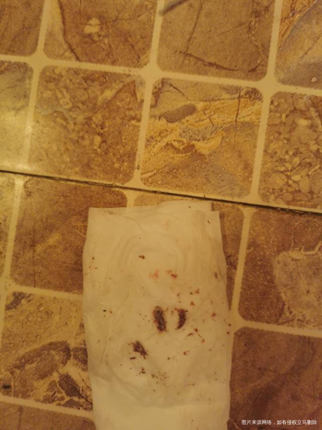 移植第26天塞的雪诺酮是第十三天没有清理过都