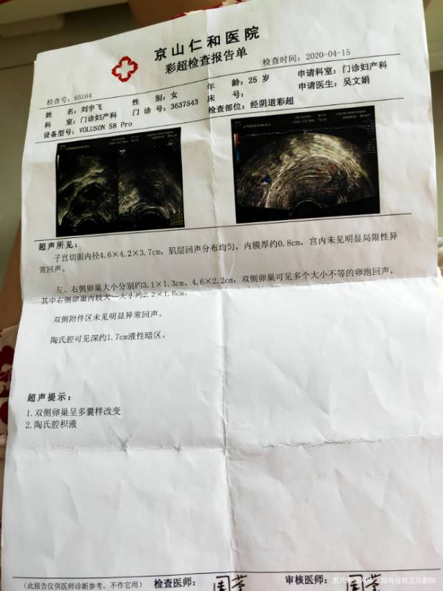 26岁多囊卵巢一年多没怀孕了上个检测排卵了没